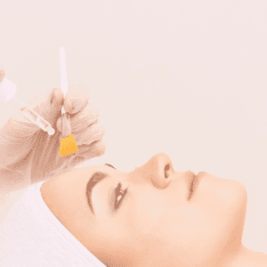 Skin treatment london