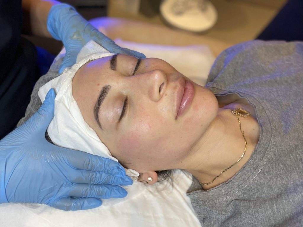 After-HydraFacial
