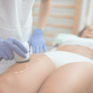 Examining-The-Link-Between-Cellulite-And-Shockwave-Therapy