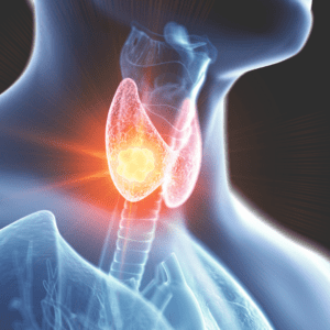 How-To-Treat-Hypothyroidism