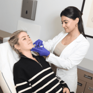 Marionette Line Filler