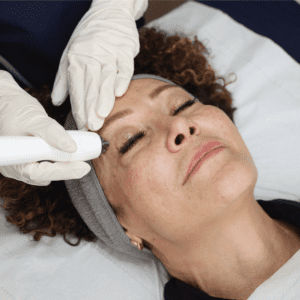 non surgical facelift on a woman being done