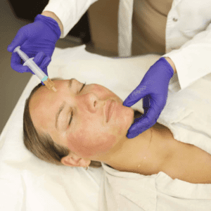 Vampire facial being perfomed