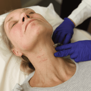 Neck lift treatment being performed at Omniya
