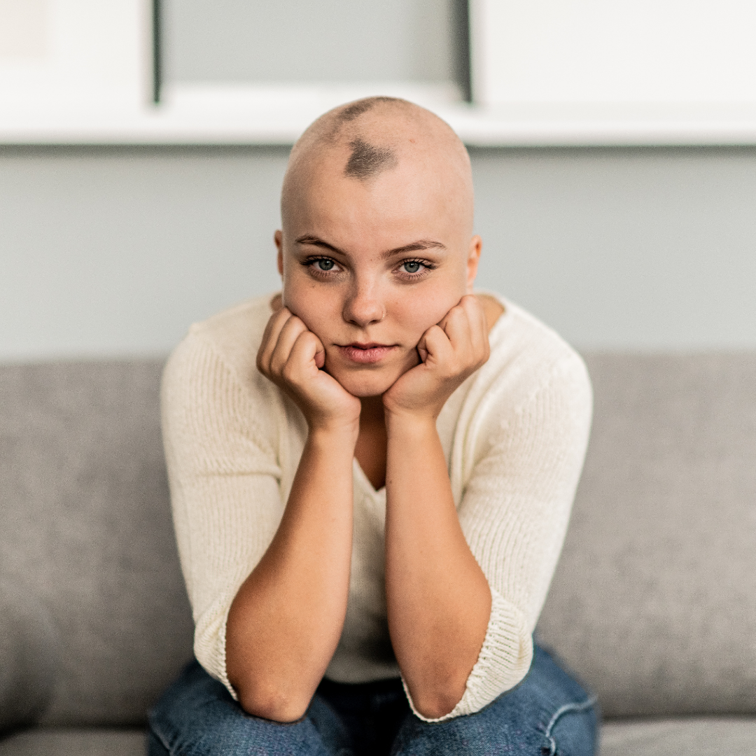 alopecia image of patient with condition