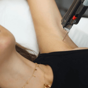 laser hair removal on an armpit