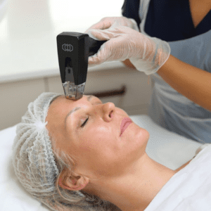 Morpheus8 Treatment being performed on a woman