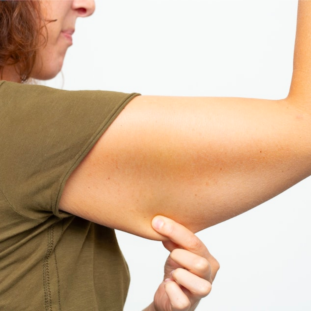 Sagging underarm skin