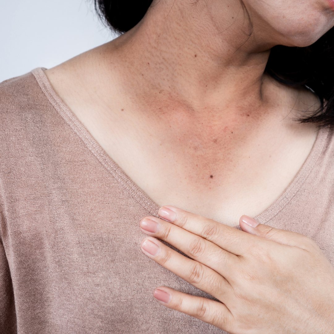 example of skin damage on a person