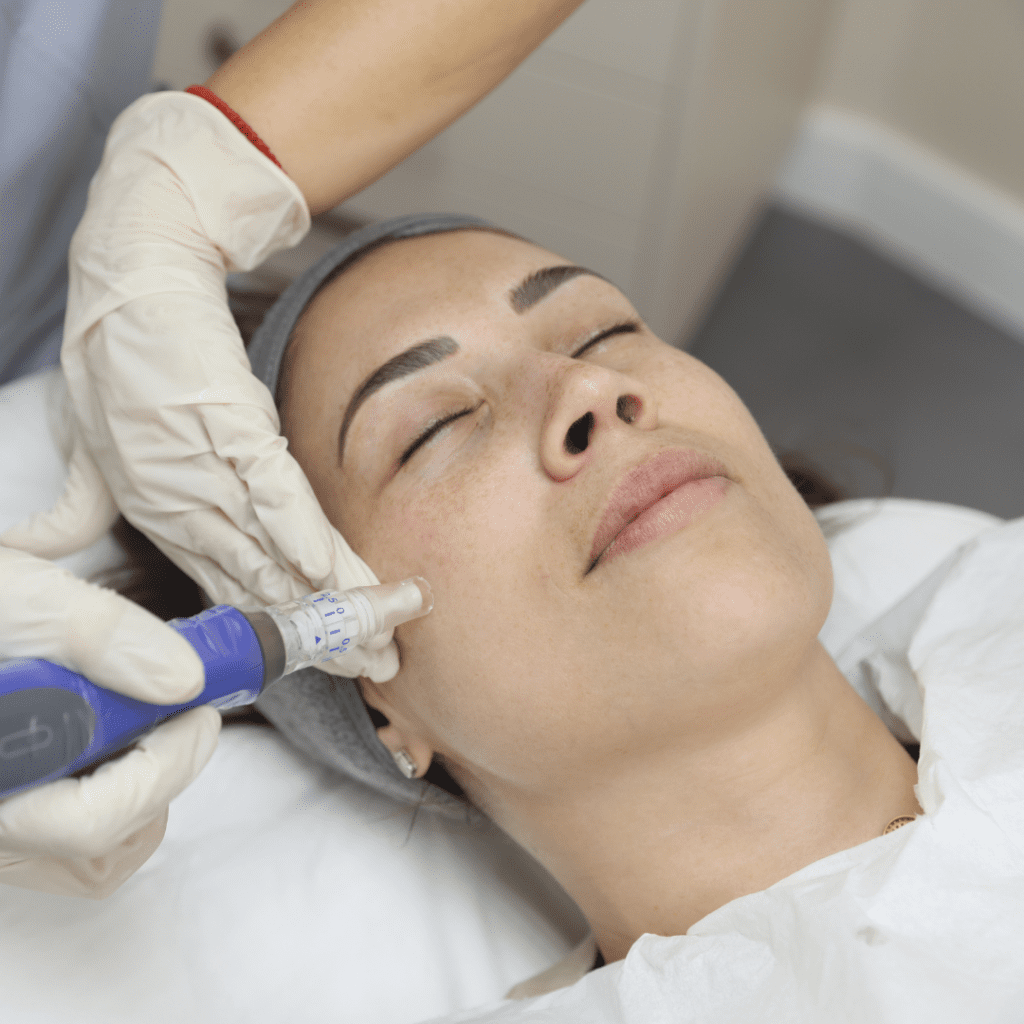 Skinpen treatment at Omniya