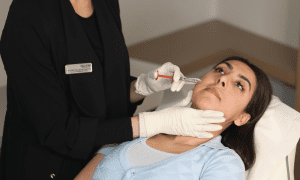 Smile Line Fillers treatment at OMniya London