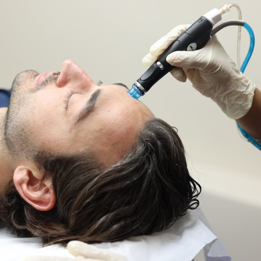 hydraneedling with is dermapen or skinpen microneedling and hydrafacial