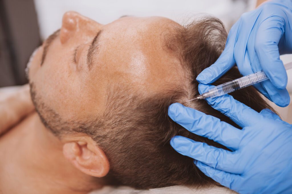 hair growth injections PRP treatment