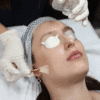 chemical peel London PCA Obagi blue radiance perfect peel