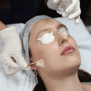 chemical peel London PCA Obagi blue radiance perfect peel