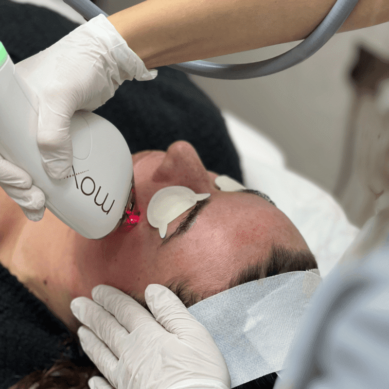 Advanced Treatments Requiring Full Sun Avoidance