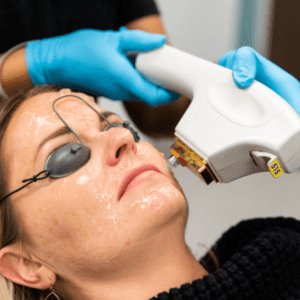 skintyte treatment bbl laser moxi facial