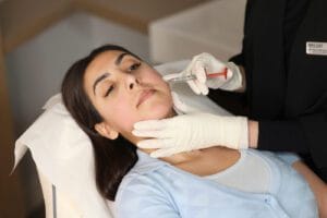 nose to mouth line filler and nasolabial fillers treatment