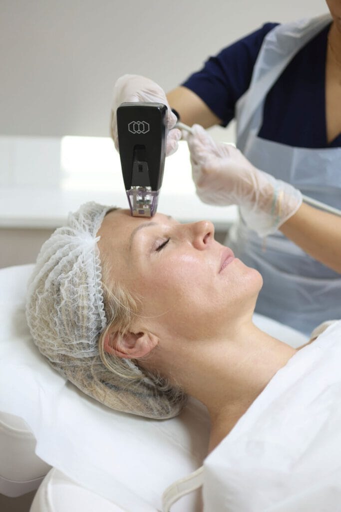 exosome and morpheus8 treatment