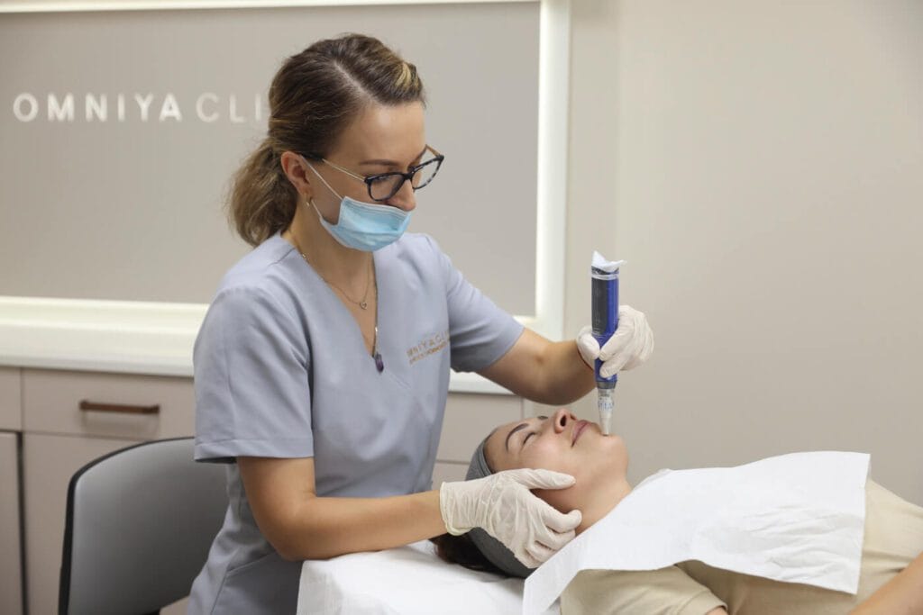 microneedling and exosomes on chin