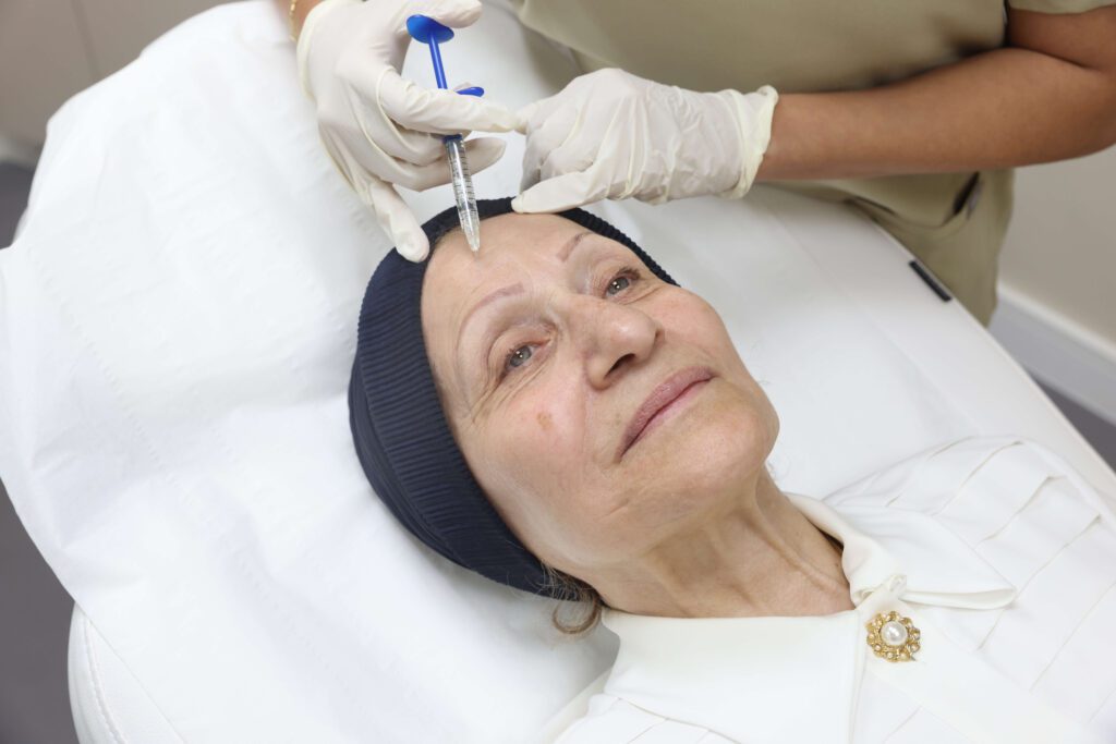 Forehead Botox performed on middle aged lady
