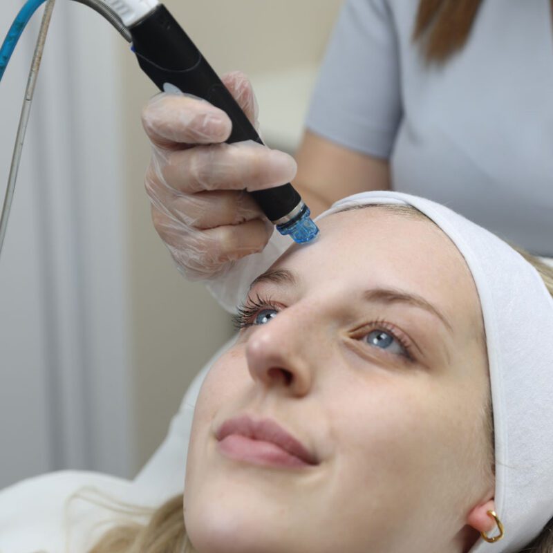 Treatments with No or Minimal Sun Avoidance